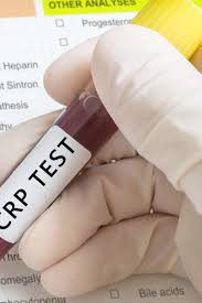 A blood test called the sedimentation rate (sed rate) is a crude because of the inflammatory component of atherosclerosis, it may correlate with an elevated crp. C Reactive Protein Crp Test High Levels Low Levels And Normal Range