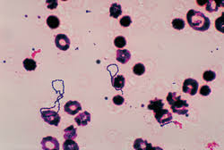 Image result for Group D Streptococcus