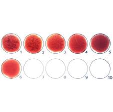 Image result for Agglutination Test