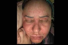 Fundraiser for Emily Cruz by Nina Venter : Emily's Breast Cancer Journey