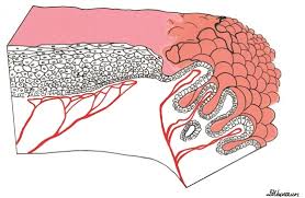 Image result for Colposcopy Findings