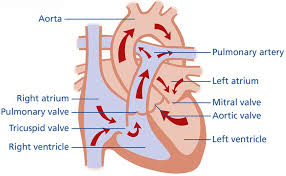 Image result for Ventricular Septal Defect
