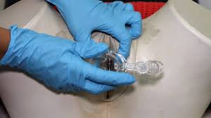 During the procedure, you might feel a little discomfort but. Vaginal Swabs Osce Guide Chlamydia Gonorrhoea Geeky Medics