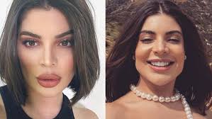 Participante de reality perde 111 quilos e surpreende com nova aparência