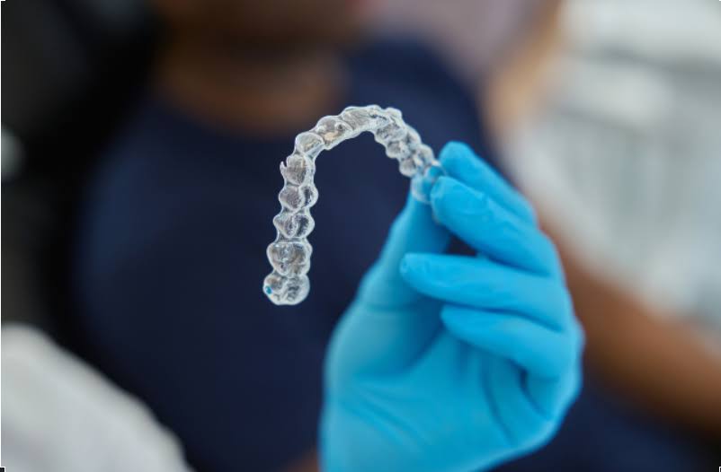 Clear Aligners product image
