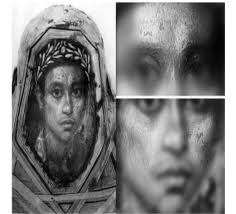 Хирургическое лечение пациентов с рубцовыми деформациями челюстно-л