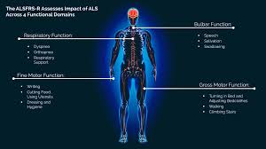 Amyotrophic lateral sclerosis is a neurodegenerative neuromuscular disease that results in the progressive loss of motor neurons that control voluntary muscles. Pipeline Brainstorm Discover Innovate Deliver Delivering On The Promise Of Cellular Therapeutics