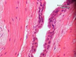 The purpose of the urinary system is to eliminate waste from the body. Jimvet 01 2 2017 Issn Histologi Ureter Dan Vesika Urinaria Ikan Lele Lokal Clarias Batrachus Pdf Download Gratis