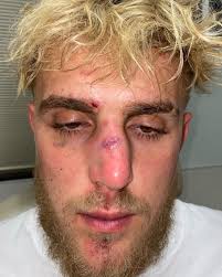 Throughout his career, paul has become the subject of many controversies due to his behavior including engaging in risky stunts and featuring age. Jake Paul On Twitter Broke My Nose Meditating 3 Weeks Ago And Couldn T Spar Leading Up To The Fight Boxing Documentary Coming Soon
