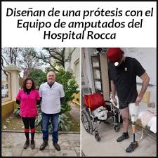 En el Hospital Rocca diseñaron una prótesis para miembro inferior con  rodilla y tobillo móvil