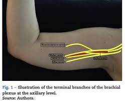 Image result for Axillary Nerve Block