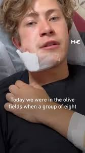 Israeli settlers attack foreign volunteers in the West Bank :  r/palestinenews