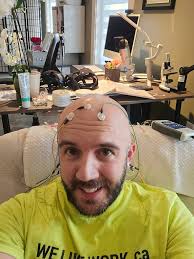 The Brain was... Abby normal ?