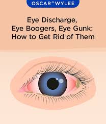 Image result for Eye Discharge