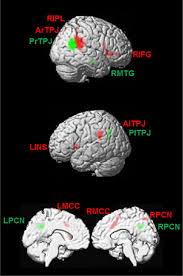 Rtpj perasmian map mustaffa kamil ayub. The Role Of The Right Temporoparietal Junction In Attention And Social Interaction As Revealed By Ale Meta Analysis Abstract Europe Pmc