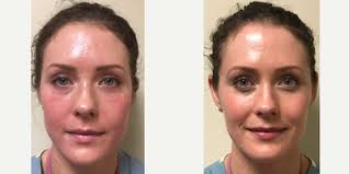 Amber Leis, MD, Board Certified Plastic Surgeon