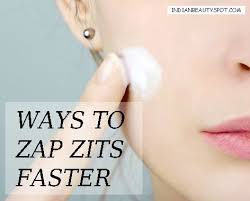 Search For Label Quick Tips Theindianspot Zits Home Remedies For Acne Best Acne Treatment