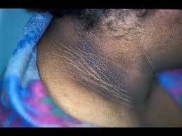 How To Get Rid Of Dark Neck In 15 Minutes Skin Lightening Fairness Cream Dark Spots On Neck Face Serum Dark Spots Dark Spots On Face