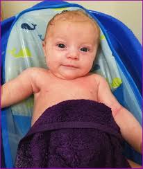 What to do with a 4.5 Risser score?