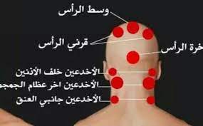 أماكن الحجامة في الرأس بالصور وفوائدها وأضرارها زيادة