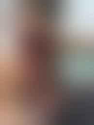 閲覧注意】顔のココを切られると、人の顔は崩れ落ちるらしい・・・（画像あり） - ポッカキット