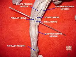 You could actually cause permanent damage by incorrectly applying your leg wraps. Achilles Tendon Wikipedia