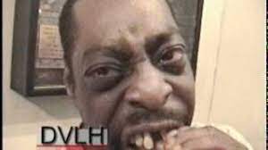 You can easily & cheaply make your own false teeth at home using these 4 methods updated for 2021. Beetlejuice S Teeth Before His Dentist Appointment To Remove Them Dvlh Youtube