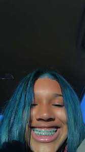 Black And Baby Blue Braces Blue Braces Braces Orthodontics Smiles Philbin Reinheimer Orthodontics In Annapolis Md And Stevensville Mar Braces Colors Cute Braces Cute Braces Colors