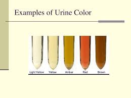 Ppt Examination Of Urine Powerpoint Presentation Free