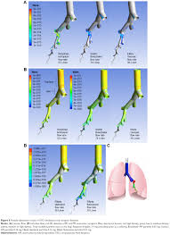 Here is a comprehensive guide to inhaler types, colours, names, escalation of treatment and the inhalers right for each group of patients. Full Text In Vitro Dose Comparison Of Respimatr Inhaler With Dry Powder Inhalers Copd