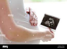 Scanner De Bébé Banque D'image Et Photos - Alamy