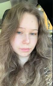 Who would win Black Star or Killua