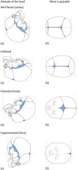 Maybe you would like to learn more about one of these? Labour 1 Mechanism Anatomy And Physiology Obgyn Key