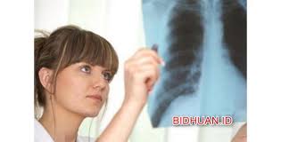 Kenali lebih jauh terkait asma, sesak napas dan gejala penyakit paru lainnya. 15 Ciri Ciri Paru Paru Basah Yang Berbahaya Pada Anak Dan Dewasa Serta Gejalanya Berbagi Cerita Opini Edukasi Dan Hiburan