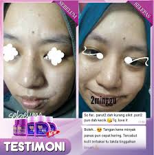 Whatsapp untuk harga promosi testimoni pengguna bagi dianz vitamin kelebihan produk: Dianz Pixy Stokis Testimoni Dianz Vitamin C E Plus 2017