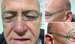 In this case, the tattoo artist sued warner bros. Man Wakes Up After Stag Do With Ray Ban Glasses Tattooed On His Face Uk News Express Co Uk