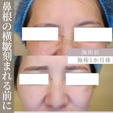 福岡Shiwa美容皮膚科