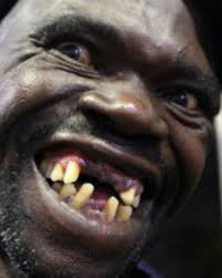 Ever since she was dubbed the world's ugliest woman in a video posted on youtube in 2006, when she was 17, velásquez has spoken out against bullying. Jeffrey Gettleman On Twitter This Still Cracks Me Up Zimbabwe S Ugliest Man Ain T Ugly Enough Https T Co Loxsmeya2z Https T Co I434ygnvs8