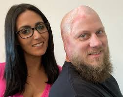 Homem acorda do coma após ser eletrocutado na cabeça por 4.160 volts, nos  EUA