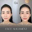 Nado Beauty Clinic | FULLFACE COMBO ADJUSTMENT WITH NADO BEAUTY ...