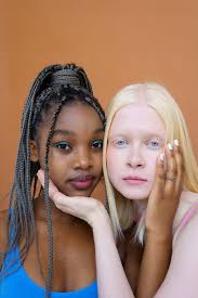 Portrait Of A Young Black Woman And Albino Woman" by Stocksy Contributor  "Roman Shalenkin"