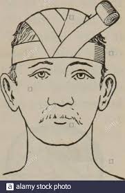 Drawing theory human anatomy drawing theory. Practical Nursing A Text Book For Nurses Bandages Strappings And Splints 465 Make Traction On The Bandage With The Right Handto Draw It Well Into Place Make Each Reverse Di Rectly Above