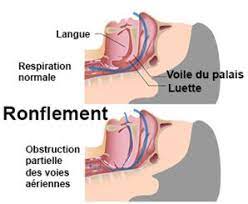 La relaxation ou même une thérapie pourrait vous aider à évacuer le stress et les troubles émotionnels. Nausees Persistantes Et Serrement De Gorge Questions Reponses Sante Docteurclic Com