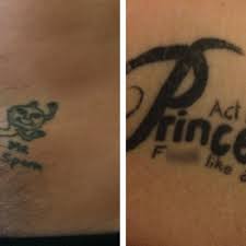 We did not find results for: Which Tattoo Do You Think Is The Worst In Devon You Can Vote For Your Favourite Here Devon Live