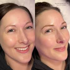 Platinum Beauty 124