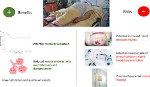 Image result for Proning