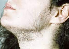 Everyman wants to be able to grow a thick beard or mustache from the age they realize they should be able to. Surprising Facts About Facial Hair Growth During Pregnancy