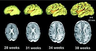 Image result for Preterm Infant Growth