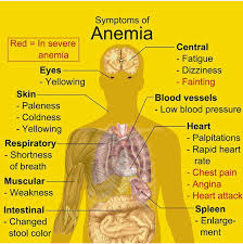 Anemia occurs when there are not enough healthy red blood cells to carry oxygen to your body's organs. Symptoms Of Anemia