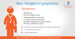 Non Hodgkin S Lymphoma Symptoms Bmthospital Bonemarrowtransplant Lymphoma Non Hodgkins Lymphoma Symptoms Lymphoma Cancer Prevention